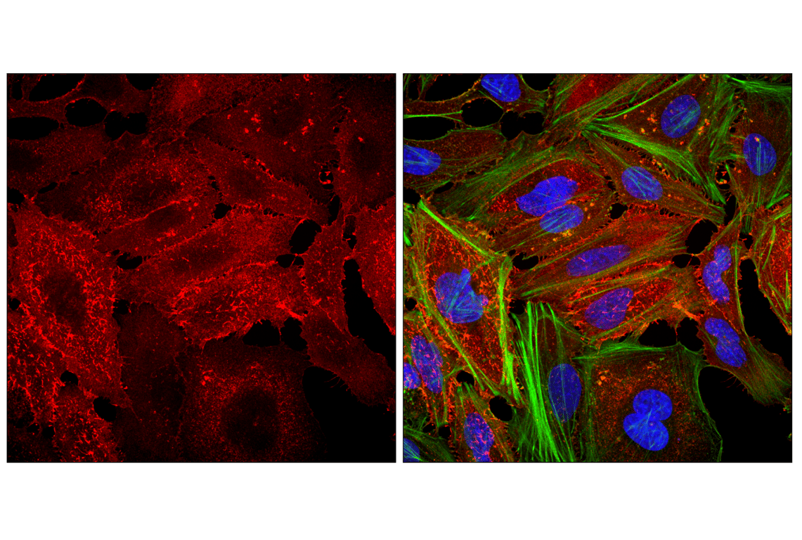 Immunofluorescence Image 1: Goat Anti-Mouse IgG2a Antibody (Alexa Fluor<sup>®</sup> 647 Conjugate)
