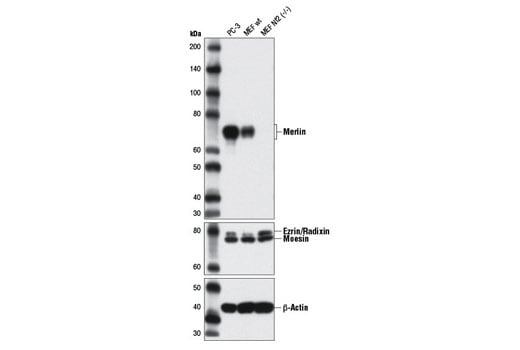 Western Blotting Image 1: Merlin (D3S3W) Rabbit mAb