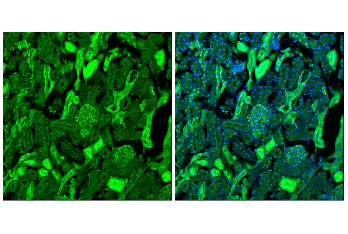 Immunofluorescence Image 2: YAP (D8H1X) XP<sup>®</sup> Rabbit mAb