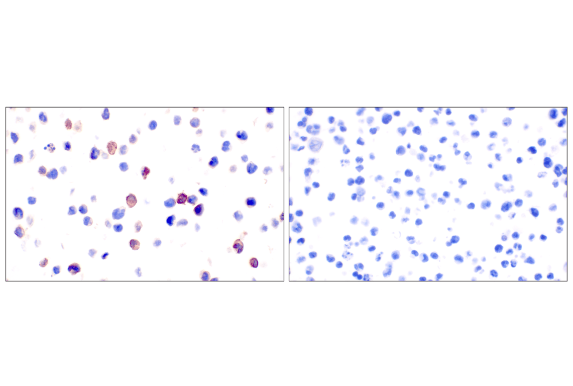 Immunohistochemistry Image 9: GLIPR2 (F7H7V) Rabbit mAb