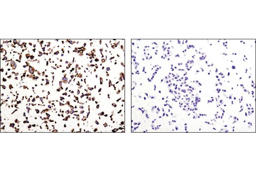 Immunohistochemistry Image 3: N-Cadherin (D4R1H) XP<sup>®</sup> Rabbit mAb