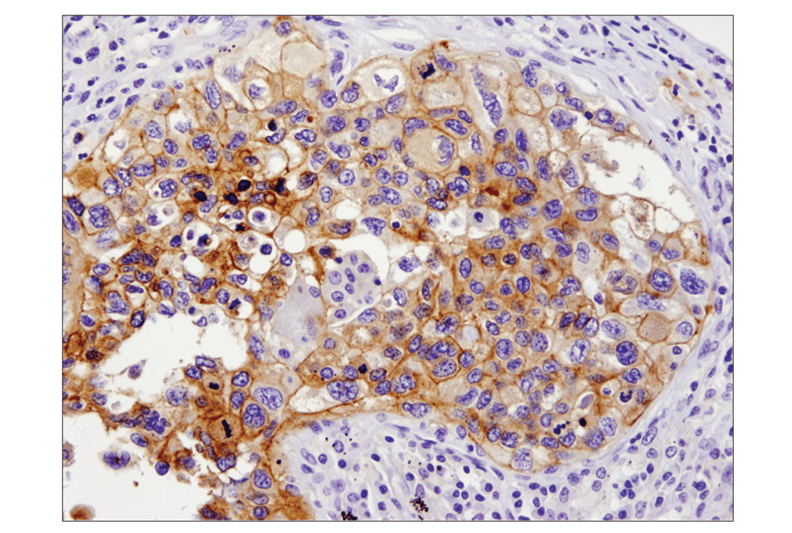 Immunohistochemistry Image 1: PD-L1 (E1L3N<sup>®</sup>) XP<sup>®</sup> Rabbit mAb