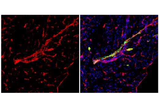 Immunofluorescence Image 1: CD34 (E2J1K) Rabbit mAb