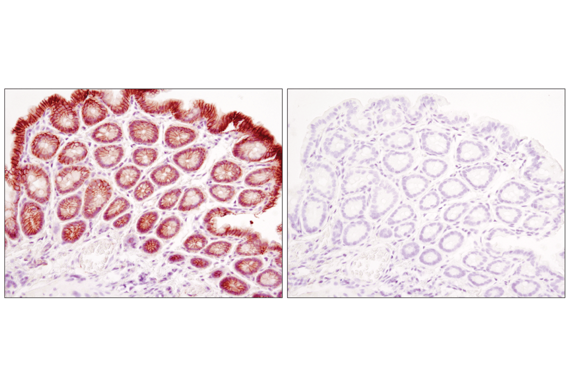 undefined Image 45: Cadherin-Catenin Antibody Sampler Kit
