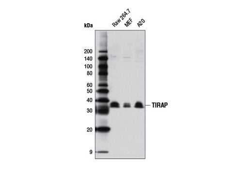 Western Blotting Image 2: TIRAP (D6M9Z) Rabbit mAb