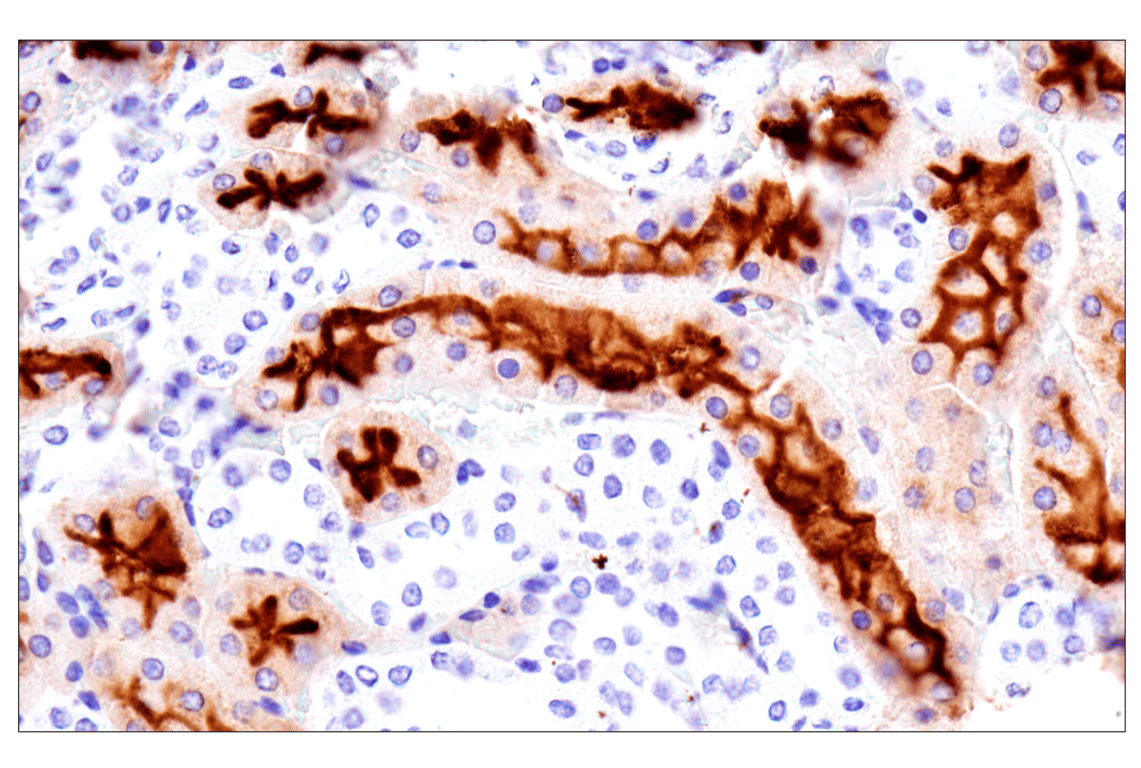undefined Image 40: SARS-CoV-2 Virus-Host Interaction Antibody Sampler Kit