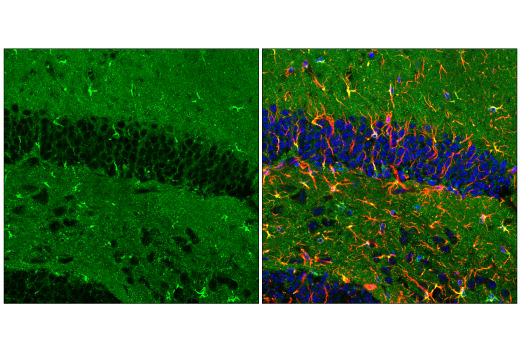 Immunofluorescence Image 3: ApoE (E7X2A) Rabbit mAb (BSA and Azide Free)