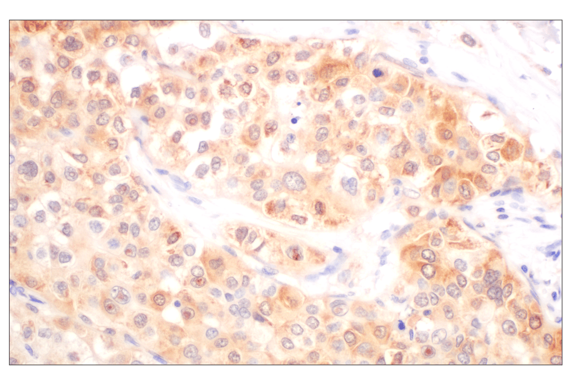 Immunohistochemistry Image 5: Galectin-8/LGALS8 (F9O3T) Rabbit mAb