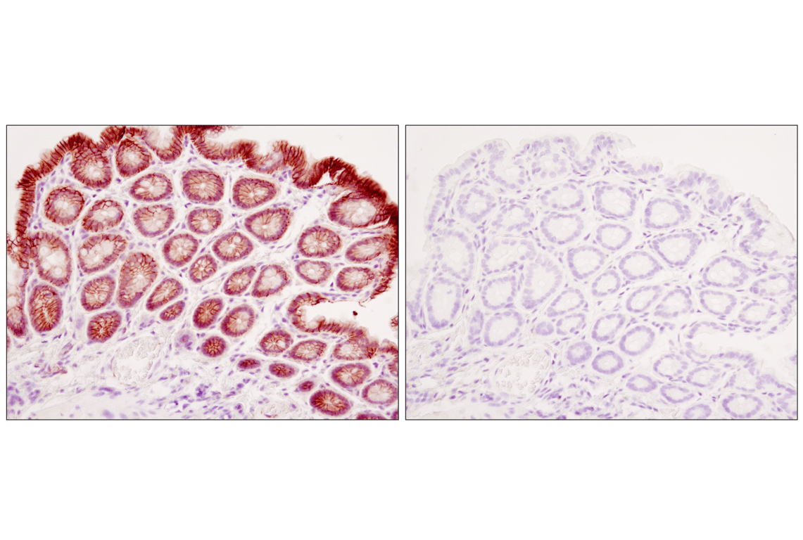 Immunohistochemistry Image 4: β-Catenin (D10A8) XP<sup>®</sup> Rabbit mAb (BSA and Azide Free)