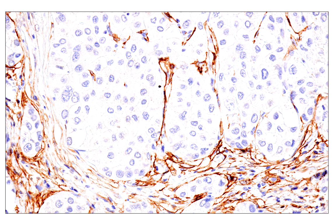 Immunohistochemistry Image 3: p75NTR (E7I3M) Rabbit mAb