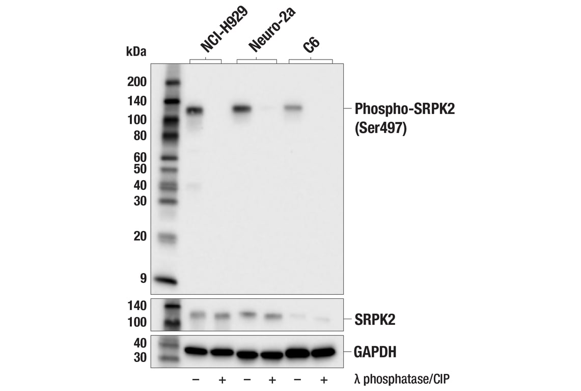 Western Blotting Image 1: Phospho-SRPK2 (Ser497) (E5T6B) Rabbit mAb