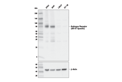 Androgen Receptor Antibody Sampler Kit: Image 1