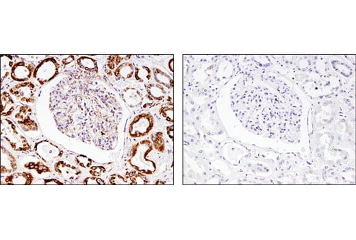 Immunohistochemistry Image 3: SOD2 (D3X8F) XP<sup>®</sup> Rabbit mAb