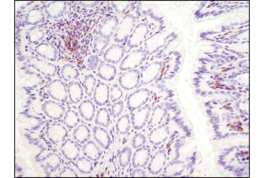 undefined Image 8: PhosphoPlus<sup>®</sup> Btk (Tyr223) Antibody Duet