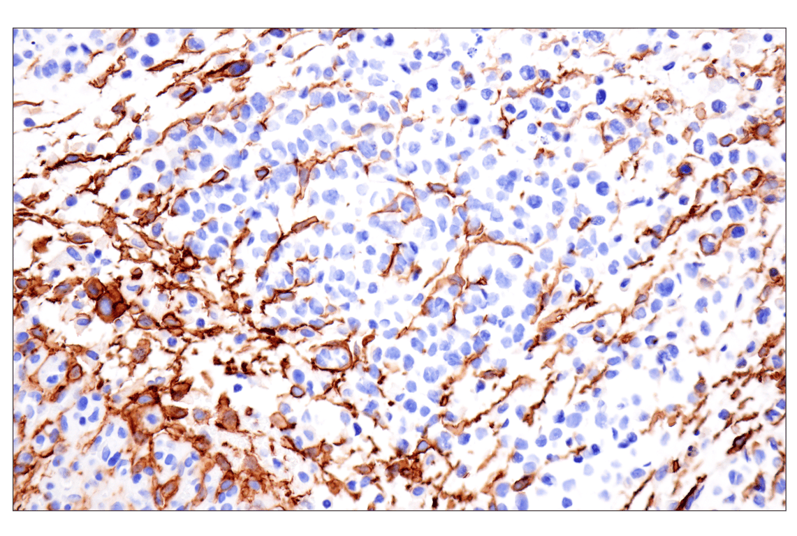 Immunohistochemistry Image 7: LRRC15 (E4X8J) Rabbit mAb