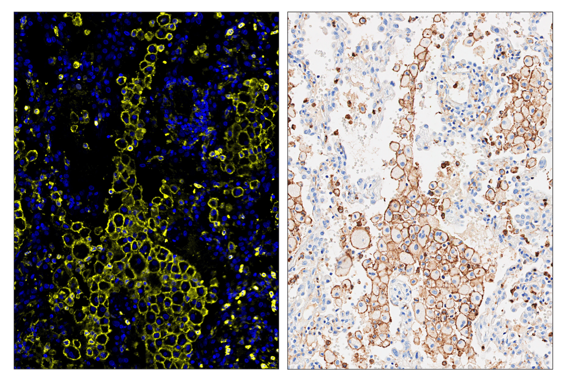 Immunohistochemistry Image 6: CD11b/ITGAM (D6X1N) & CO-0037-647 SignalStar<sup>™</sup> Oligo-Antibody Pair