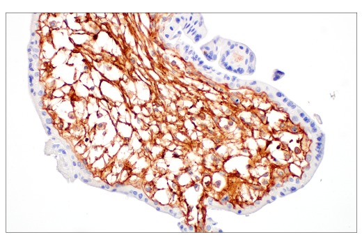 Immunohistochemistry Image 6: COL14A1 (E5W8S) Rabbit mAb (BSA and Azide Free)