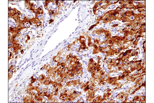 Immunohistochemistry Image 1: Ret (E1N8X) XP<sup>®</sup> Rabbit mAb (BSA and Azide Free)