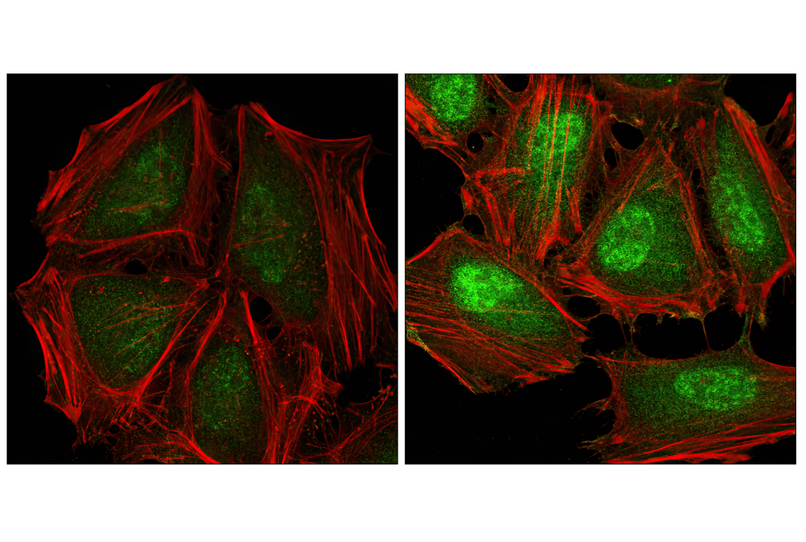 Immunofluorescence Image 1: Phospho-p38 MAPK (Thr180/Tyr182) (28B10) Mouse mAb