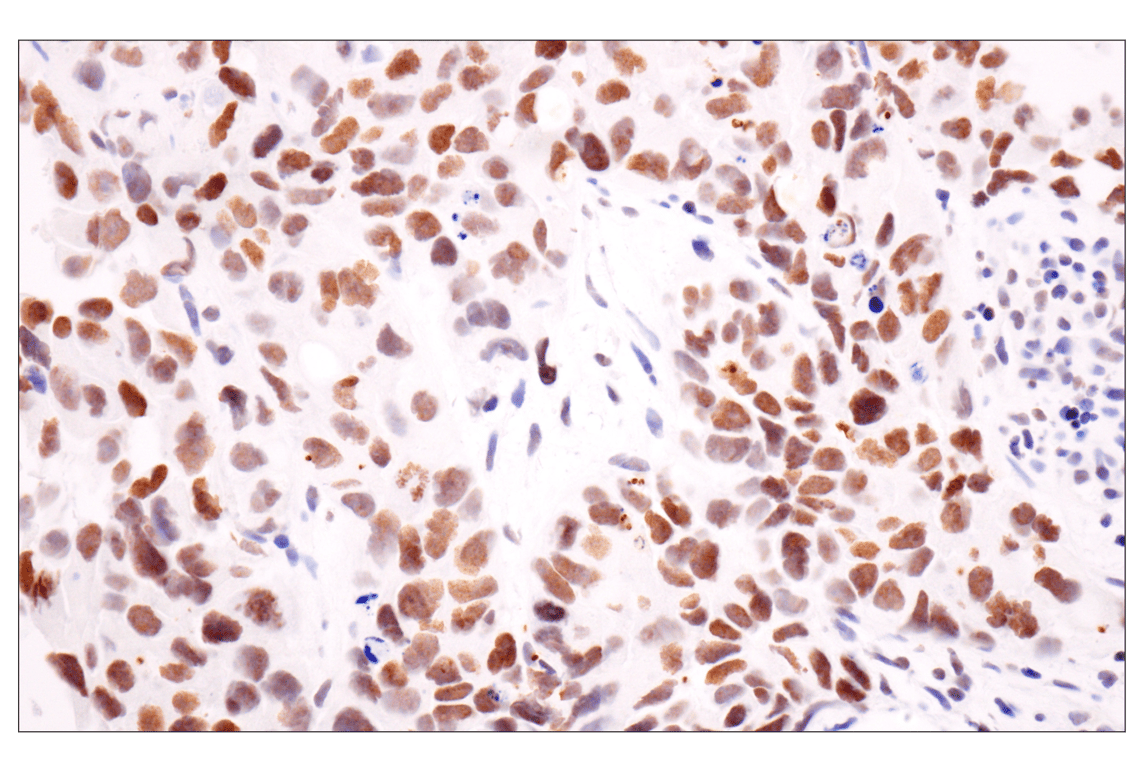 Immunohistochemistry Image 1: Acetyl-Histone H4 (Lys16) (E2B8W) Rabbit mAb