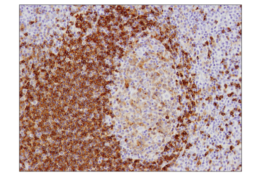 Immunohistochemistry Image 1: CD79B (D7V2F) Rabbit mAb (BSA and Azide Free)