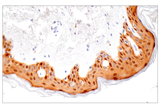 Immunohistochemistry Image 9: IL-18 (E3G8R) Rabbit mAb