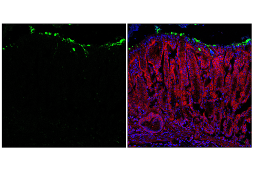Immunofluorescence Image 2: MUC5AC (E9V1O) XP<sup>®</sup> Rabbit mAb (BSA and Azide Free)