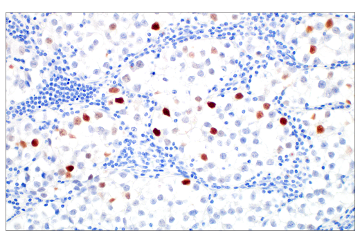 Immunohistochemistry Image 2: MAGE-C2/CT10 (E7B8D) XP<sup>®</sup> Rabbit mAb