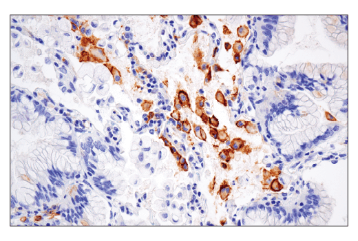 Immunohistochemistry Image 1: CD86 (E2G8P) Rabbit mAb (BSA and Azide Free)
