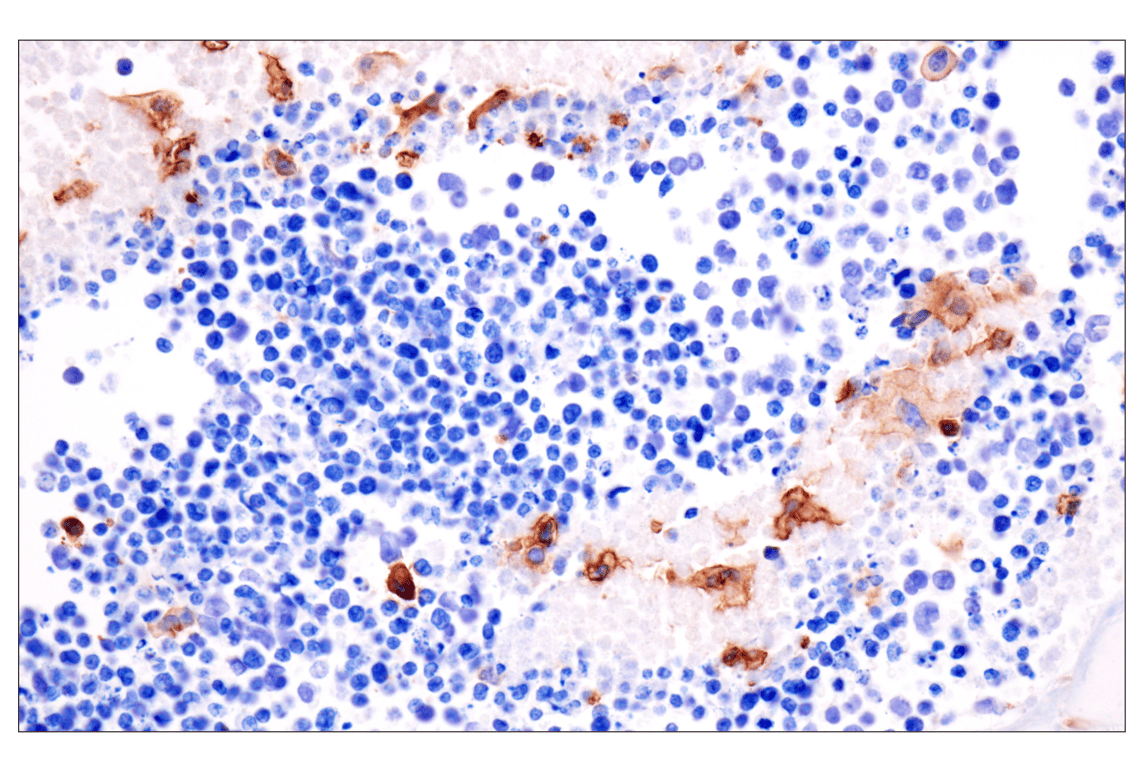Immunohistochemistry Image 4: CD14 (D1U2Y) Rabbit mAb