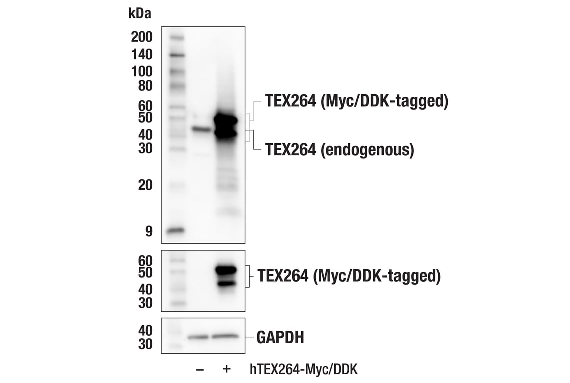 Western Blotting Image 2: TEX264 (E2J3J) Rabbit mAb