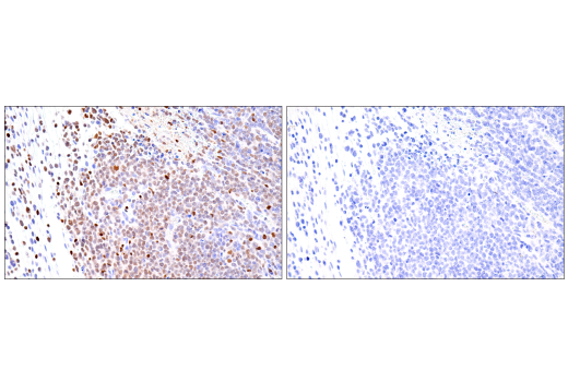 Immunohistochemistry Image 6: RUNX3/AML2 (D6E2) Rabbit mAb