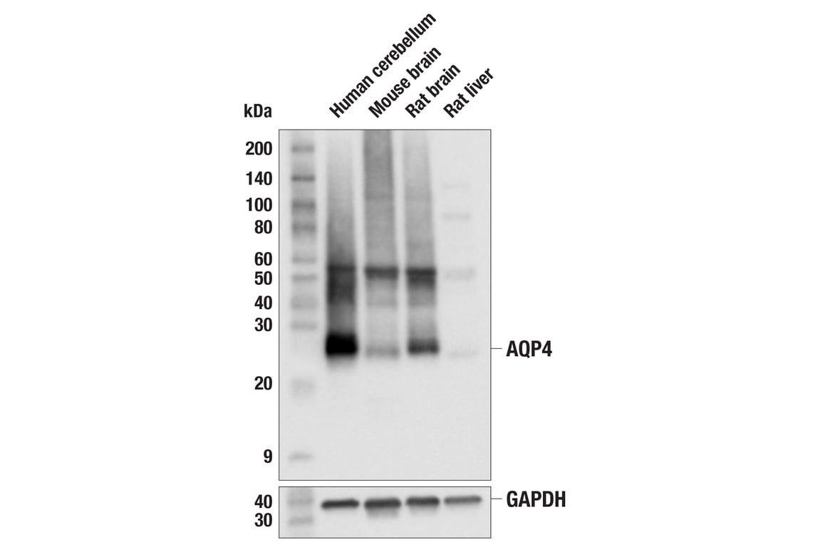 Western Blotting Image 1: AQP4 (E4B6T) Mouse mAb