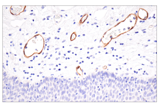 Immunohistochemistry Image 5: CD62P/P-Selectin (E8Q1W) XP<sup>®</sup> Rabbit mAb (BSA and Azide Free)