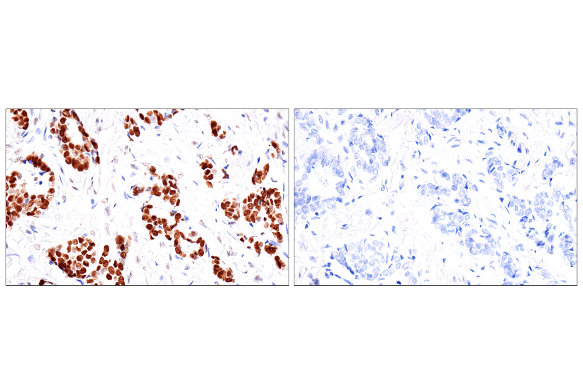 Immunohistochemistry Image 18: FoxA1/HNF3α (IHC578) Mouse mAb