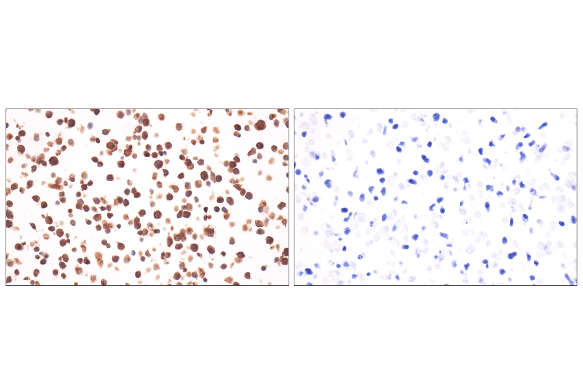 Immunohistochemistry Image 11: CD14 (D1U2Y) Rabbit mAb