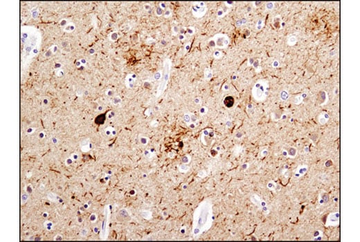 undefined Image 29: LRP1-mediated Endocytosis and Transmission of Tau Antibody Sampler Kit