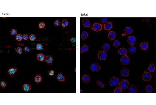 Immunofluorescence Image 1: PAX5 (D19F8) XP<sup>®</sup> Rabbit mAb