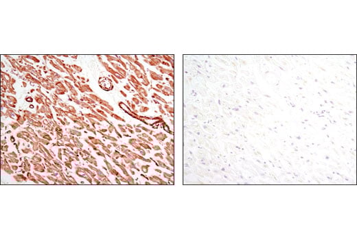 Immunohistochemistry Image 2: Pan-Actin (D18C11) Rabbit mAb