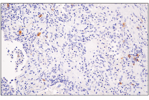Immunohistochemistry Image 2: XCR1 (D2F8T) Rabbit mAb