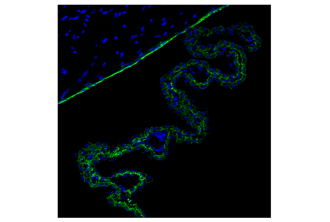 Immunofluorescence Image 2: N-Cadherin (D4R1H) XP<sup>®</sup> Rabbit mAb