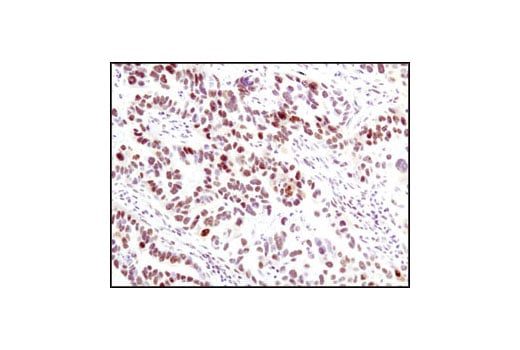 Immunohistochemistry Image 2: Phospho-MAPK Substrates (PXTP) (46G11) Rabbit mAb