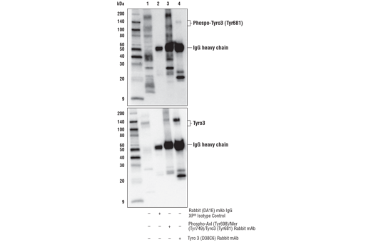 Immunoprecipitation Image 3: Phospho-Axl (Tyr698)/Mer (Tyr749)/Tyro3 (Tyr681) (D6M4W) Rabbit mAb