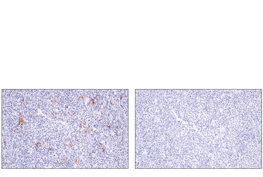 Immunohistochemistry Image 5: XCR1 (D2F8T) Rabbit mAb