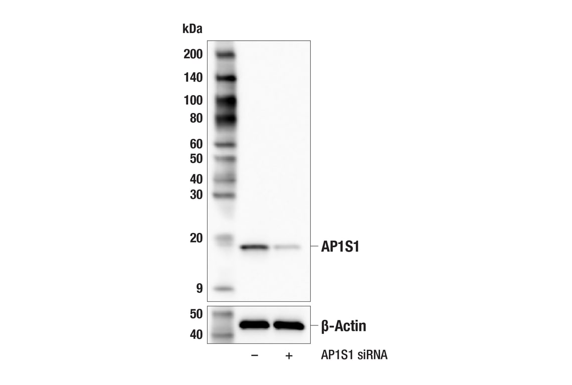 Western Blotting Image 3: AP1S1 (F8K5S) Rabbit mAb