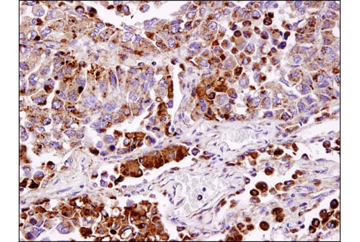 undefined Image 23: PICALM Signaling Antibody Sampler Kit
