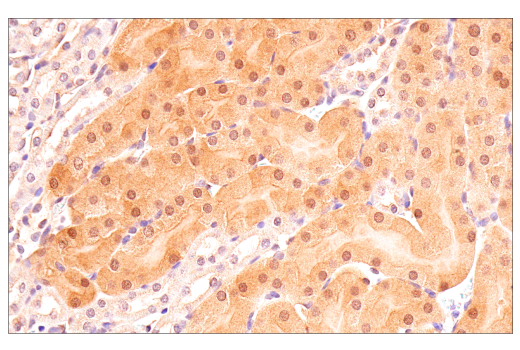 Immunohistochemistry Image 7: p70 S6 Kinase (E8K6T) XP<sup>®</sup> Rabbit mAb