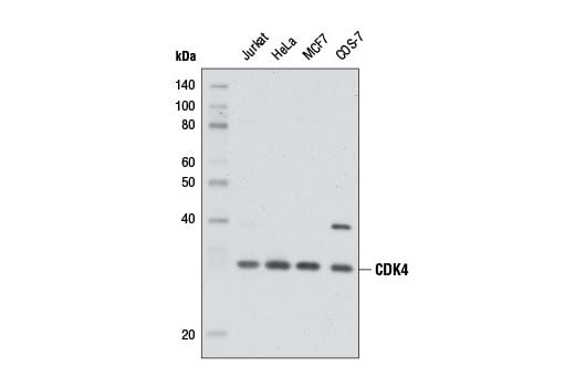 Western Blotting Image 1: CDK4 (D9G3E) Rabbit mAb (Biotinylated)