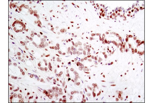 Immunohistochemistry Image 3: Histone H2A.X (D17A3) XP<sup>®</sup> Rabbit mAb (BSA and Azide Free)