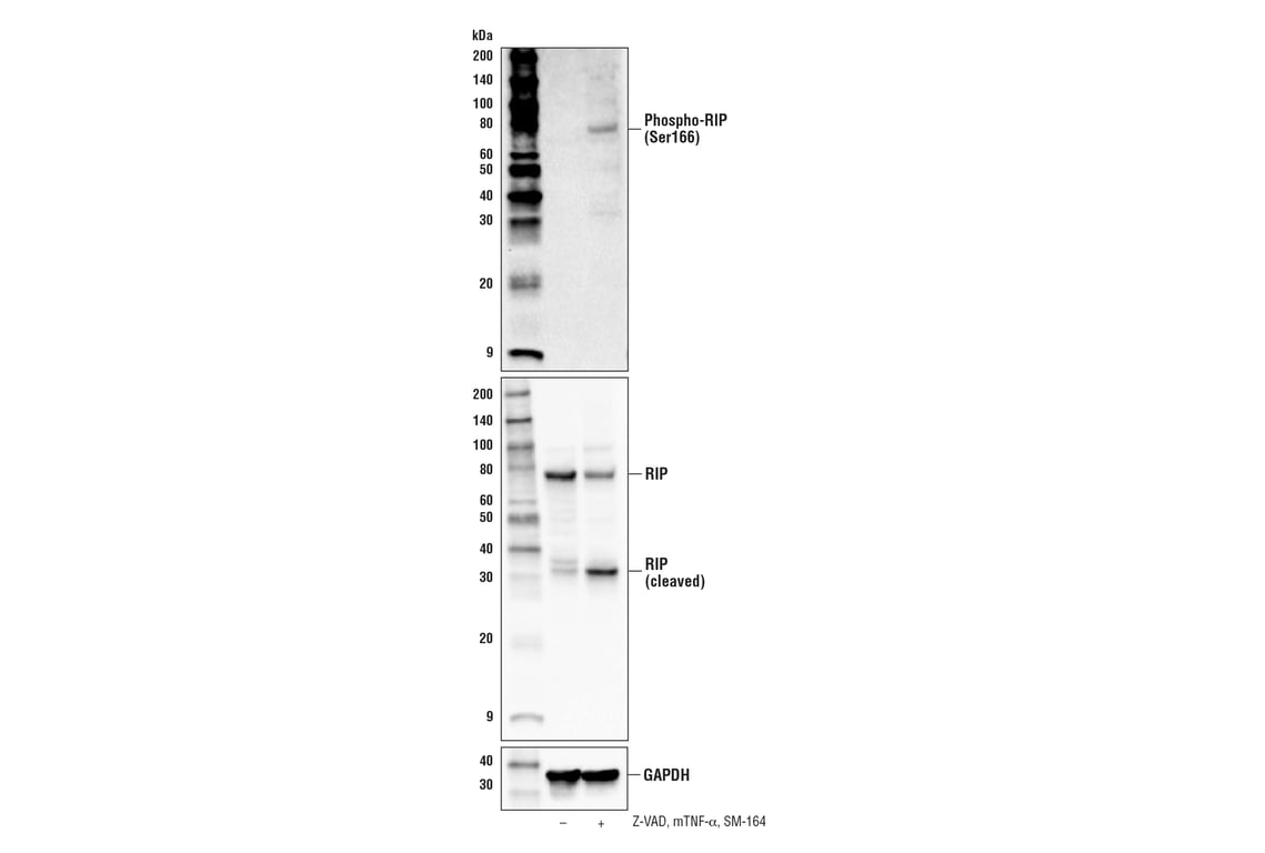 undefined Image 22: Mouse Reactive Cell Death and Autophagy Antibody Sampler Kit